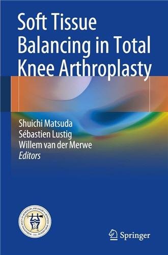 Soft Tissue Balancing in Total Knee Arthroplasty by Shuichi Matsuda, ISBN-13: 978-3662540817
