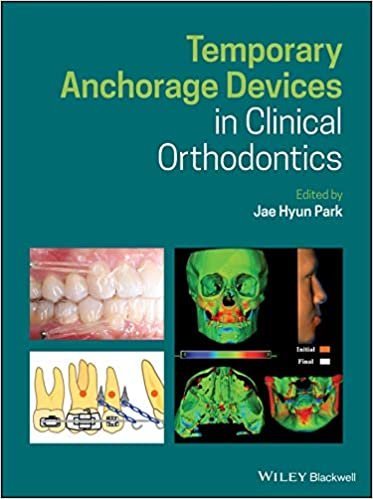 Temporary Anchorage Devices in Clinical Orthodontics, ISBN-13: 978-1119513476