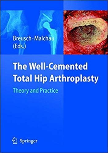 The Well-Cemented Total Hip Arthroplasty: Theory and Practice, ISBN-13: 978-3540241973