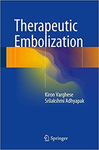 Therapeutic Embolization by Kiron Varghese, ISBN-13: 978-3319424927