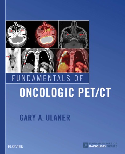 Fundamentals of Oncologic PET CT Fundamentals of Radiology by Gary A. Ulaner